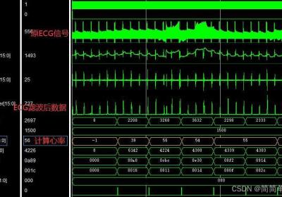 基于FPGA的ECG信号滤波与心率计算verilog实现,包含testbench