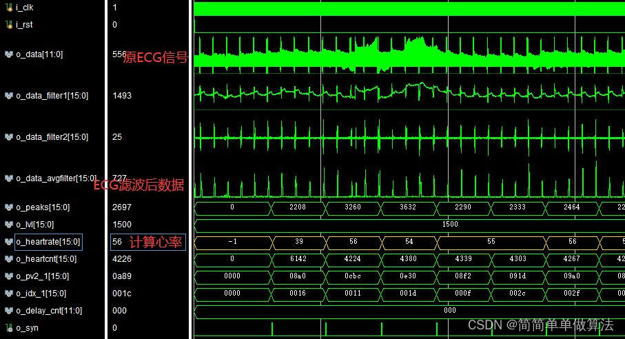 基于FPGA的ECG信号滤波与心率计算verilog实现,包含testbench,第1张